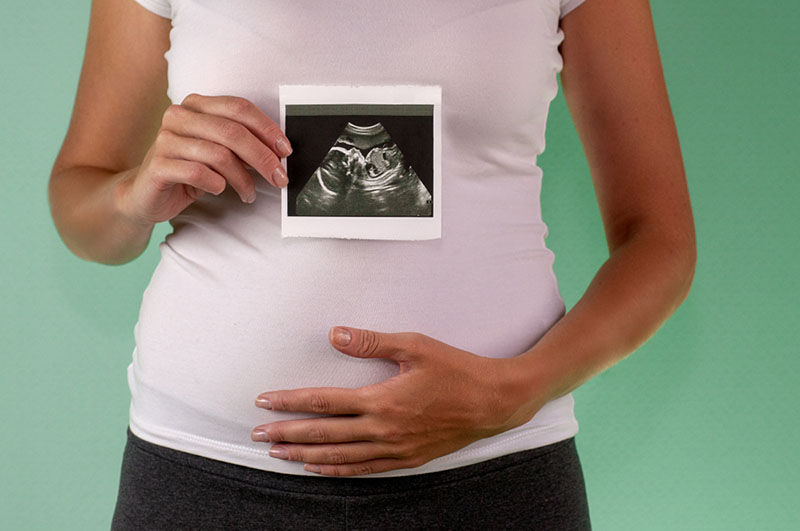 schwangere Dame, die Ultraschallbild ihrer Babyzwillinge hält