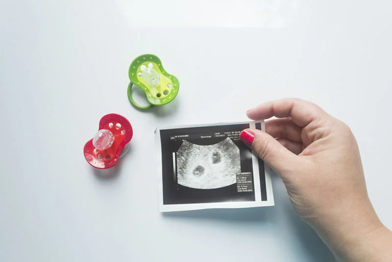 zwei Schnuller auf dem Tisch und eine Frau mit Ultraschallbild von Zwillingsbabys