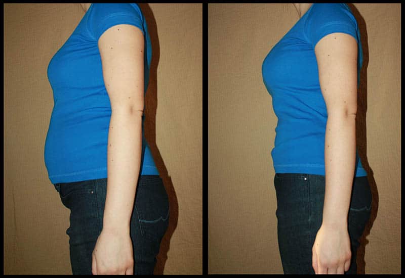 Bild des Frauenbauches vor und nach dem Bauchgurt