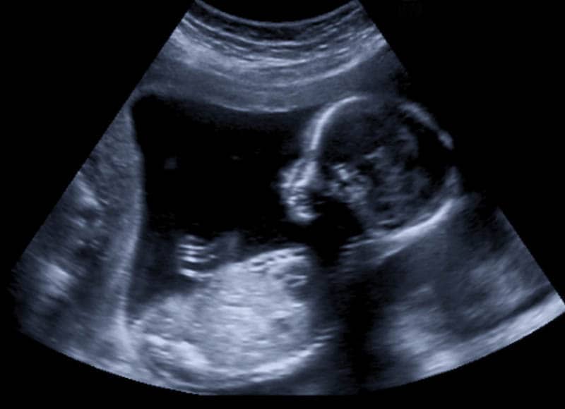 eine Ultraschalluntersuchung des Babys im Mutterleib
