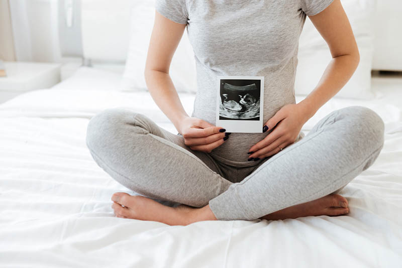 schwangere Frau hält Sonogramm des Babys auf dem Bett