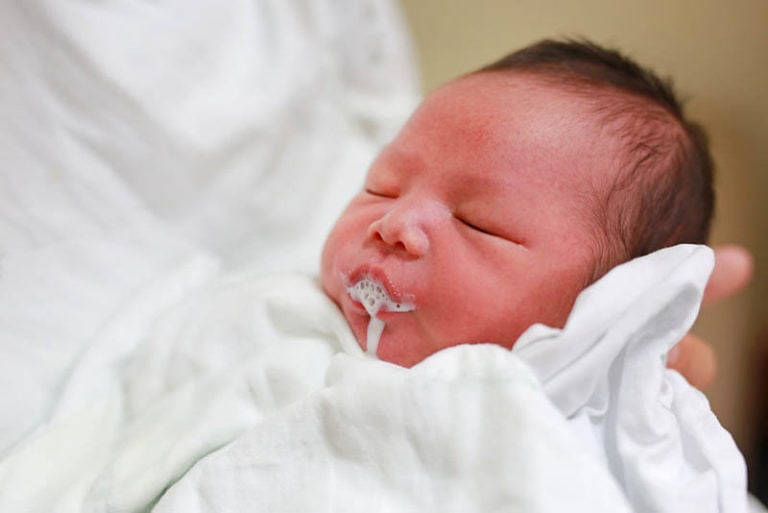 Baby Spuckt Geronnene Milch Ursachen Und Behandlungen