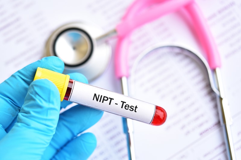 Arzt hält Blutprobe für NIPT