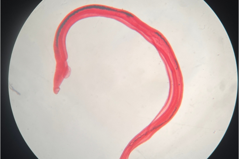 Madenwürmer unter dem Mikroskop